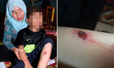 Heartless M'sian Father Abuses Young Daughter Just Because She Looks Like Ex-Wife - WORLD OF BUZZ 4