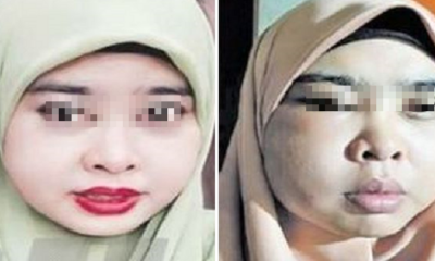 M'sian Woman Suffers From Swollen, Painful Face After Using Online Beauty Product - WORLD OF BUZZ 4