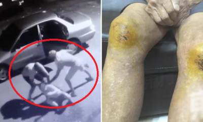Three Elderly Folks Brutally Beaten Up and Robbed When Going For Morning Walk - WORLD OF BUZZ 3
