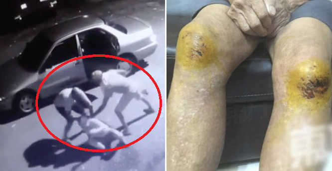 Three Elderly Folks Brutally Beaten Up and Robbed When Going For Morning Walk - WORLD OF BUZZ 3