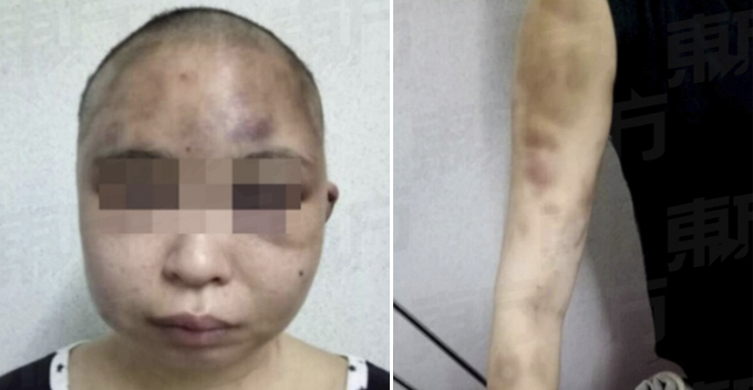 Wife's Head Shaved and Bashed After Husband Suspected Her For Having an Affair - WORLD OF BUZZ