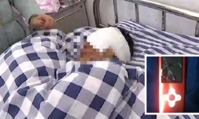 'Fake' MP3 Device from China Explodes in Young Boy's Face, Causes Serious Injuries - WORLD OF BUZZ