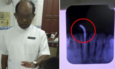 Lady Gets Braces at Ampang Clinic, Ends Up with Horrible Infection and Damaged Roots - WORLD OF BUZZ