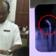 Lady Gets Braces at Ampang Clinic, Ends Up with Horrible Infection and Damaged Roots - WORLD OF BUZZ