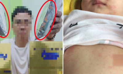 M'sian Baby Gets Admitted to Hospital For High Fever and Rashes After Drinking Fake Milk Powder - WORLD OF BUZZ