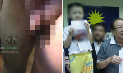 Sg Buloh Teacher Accused of Pinching 4yo Boy's Genitals Because He Refused to Nap - WORLD OF BUZZ 5