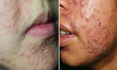 These Cosmetic Products Can Cause Terrible Damage To Your Skin, According to Health Ministry - WORLD OF BUZZ 4