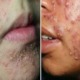 These Cosmetic Products Can Cause Terrible Damage To Your Skin, According to Health Ministry - WORLD OF BUZZ 4