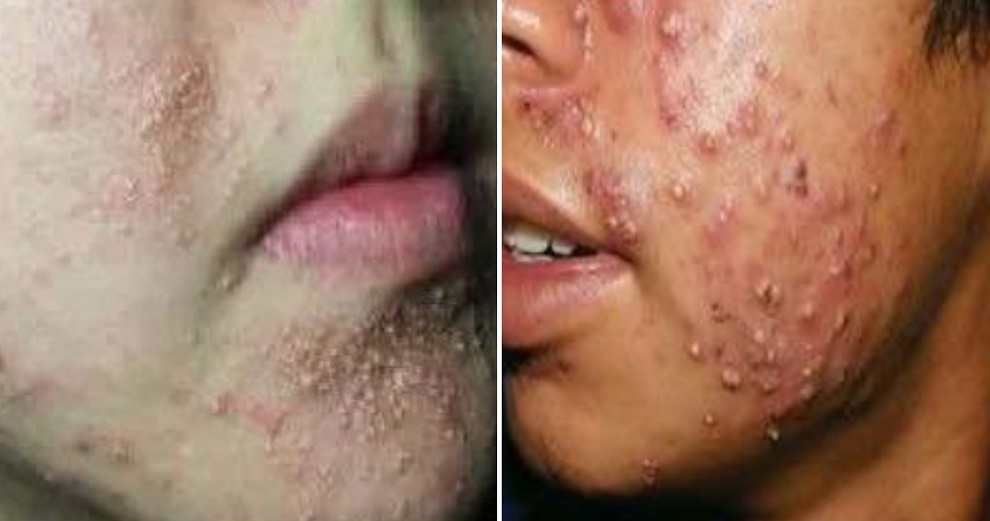 These Cosmetic Products Can Cause Terrible Damage To Your Skin, According to Health Ministry - WORLD OF BUZZ 4