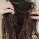 Woman Suffers from Facial Paralysis From Habitually Sleeping with Wet Hair - WORLD OF BUZZ 3