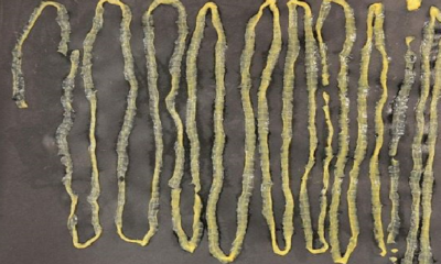Man Passes Out 2.8M-Long Tapeworm from Rectum, Had Absolutely No Idea It Was Inside - WORLD OF BUZZ 2