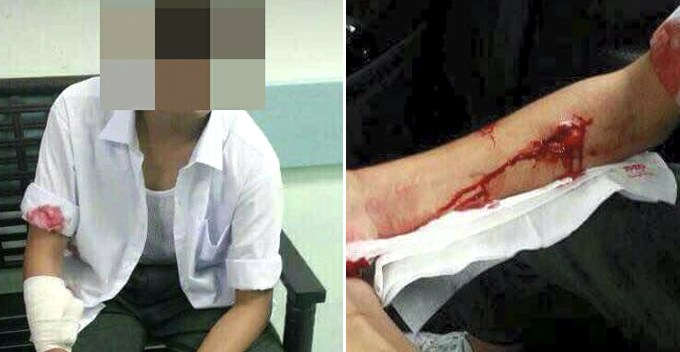 Student Allegedly Kidnapped by Men And Successfully Escaped, Truth Reveals Otherwise - WORLD OF BUZZ