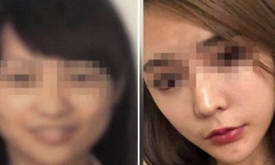 Woman Misses Flight After Security Scanner Couldn't Recognise Her Post-Plastic Surgery Face - WORLD OF BUZZ 1