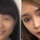 Woman Misses Flight After Security Scanner Couldn't Recognise Her Post-Plastic Surgery Face - WORLD OF BUZZ 1