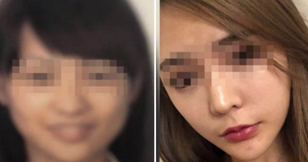 Woman Misses Flight After Security Scanner Couldn't Recognise Her Post-Plastic Surgery Face - WORLD OF BUZZ 1