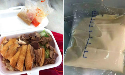 Young Lady Eats Out for 3 Meals a Day, Blood Plasma Shockingly Turns into Milky Colour - WORLD OF BUZZ