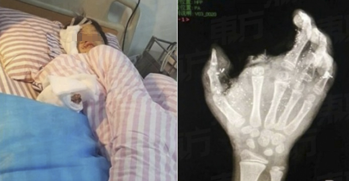 Finger Featured Image 1