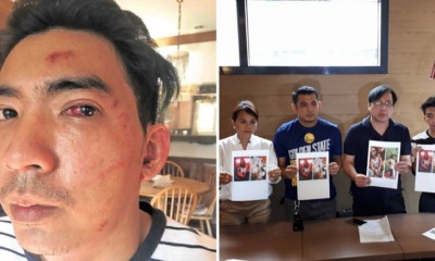 Grab Driver Returns Passenger's Handphone, Ends up Getting Punched in The Face - WORLD OF BUZZ 3