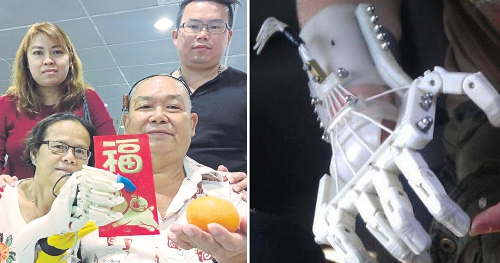 Malaysian Amputee Receives Surprise Robotic Hand From Son in Time For CNY - WORLD OF BUZZ 2