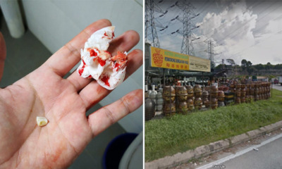 Man Suffers Fro - WORLD OF BUZZ