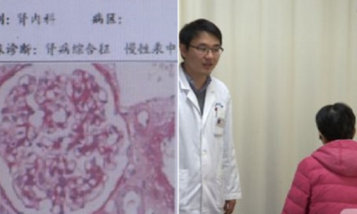 Cheap and Fast Whitening Treatment Causes Woman to Suffer From Chronic Kidney Disease - WORLD OF BUZZ 3