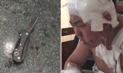 College Student Gets Stabbed After Complaining About Roommate Who Farts and Snores - WORLD OF BUZZ