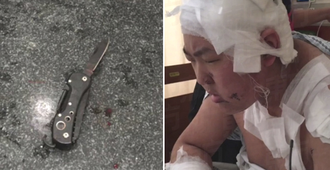 College Student Gets Stabbed After Complaining About Roommate Who Farts and Snores - WORLD OF BUZZ
