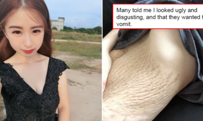 M'sian Mother of Quadruplets Attacked by Netizens After Sharing a Photo of Her Stretchmarks - WORLD OF BUZZ 4