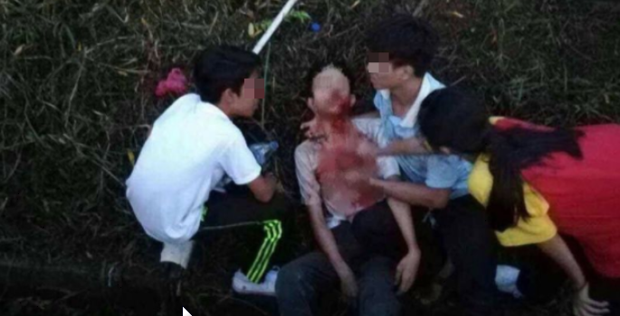 Selayang Student Seriously Injured After Getting into Fight Over Stolen Mobile Phone - WORLD OF BUZZ 1