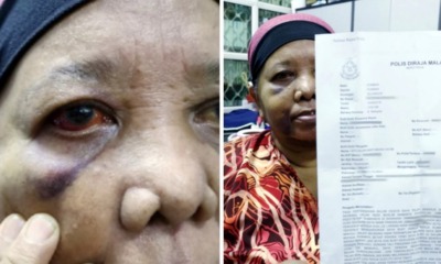 62yo Maid Climbs 2m Wall to Escape Employer Who Brutally Abused Her Until She Lost Her Hearing - WORLD OF BUZZ 4