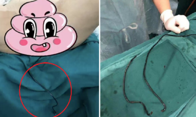 Man Hospitalised for Shoving 1M-Long Cable Into Penis to Scratch Raging Itch - WORLD OF BUZZ