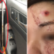 M'sian Lady Gets Injured by 3-Foot Long Iron Rod which Pierced Her Car on NKVE - WORLD OF BUZZ 2