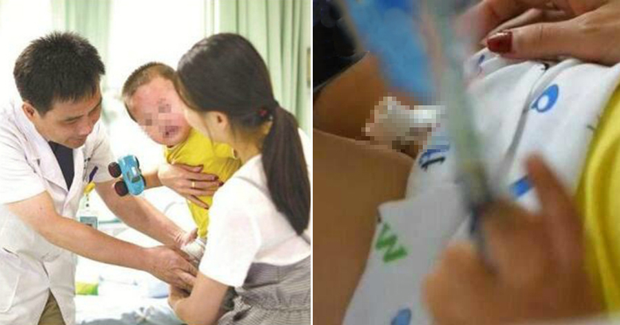 Little Boy's Foreskin Ripped Off After His Penis Gets Stuck in Escalator - WORLD OF BUZZ