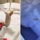 Parents Shocked to Find Their Baby With Broken Thigh Bone While Allegedly Under Babysitter's Care - WORLD OF BUZZ 2