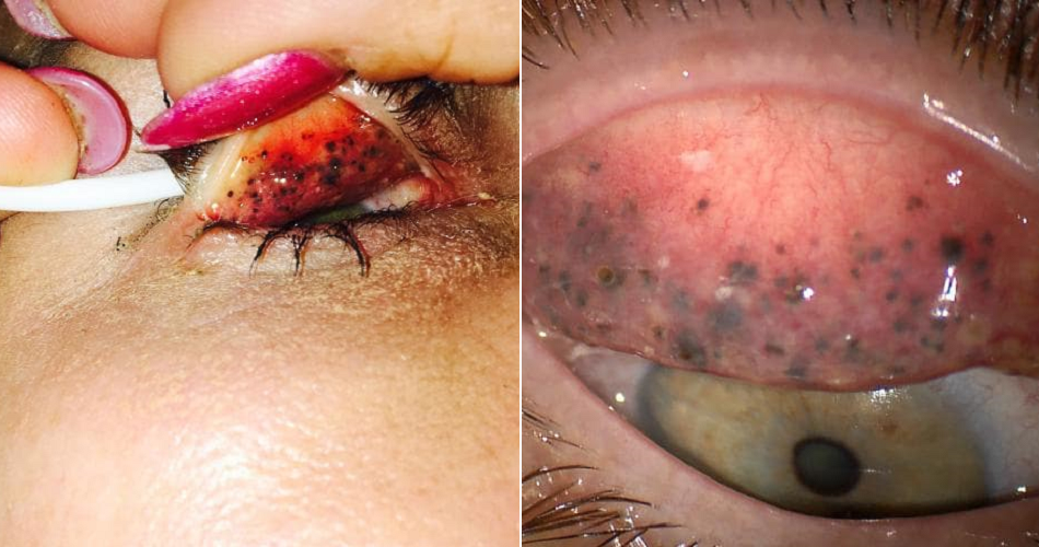 Woman Almost Went Blind For Sleeping With Mascara on For 25 Years - WORLD OF BUZZ