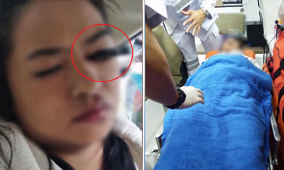 Woman Stabs Her Eye With Eyebrow Pencil While Doing Makeup in a Moving Taxi - WORLD OF BUZZ