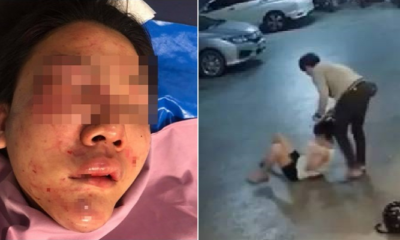 Girl Suffers Serious Injuries After Getting Brutally Beaten Up By Drunk And Jealous GF - WORLD OF BUZZ