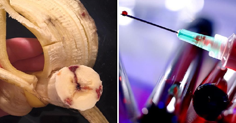 Heard of These Bizarre HIV Myths? - WORLD OF BUZZ 1