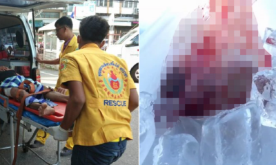 Jealous Wife Suspects Husband is Cheating, Cuts Off His Penis While Sleeping - WORLD OF BUZZ 4