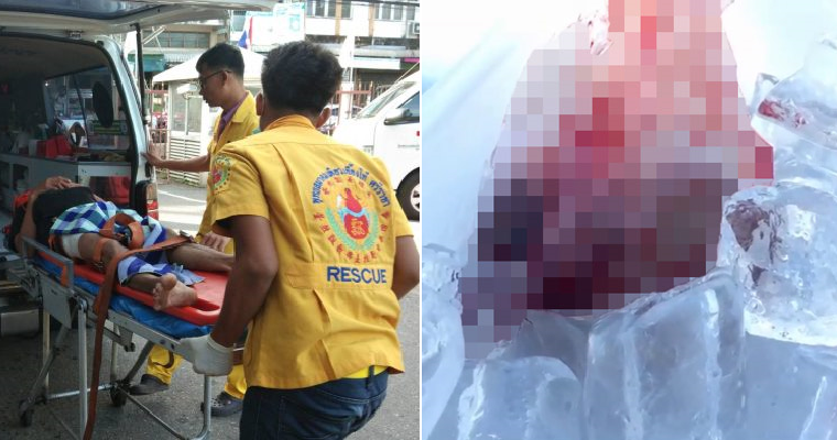 Jealous Wife Suspects Husband is Cheating, Cuts Off His Penis While Sleeping - WORLD OF BUZZ 4