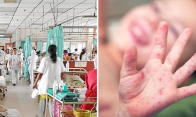 M'sian Toddler First to Die from HFMD Outbreak After Ministry of Health's Public Warning - WORLD OF BUZZ 1