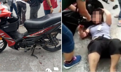 Snatch Theft Victim Dragged Few Metres After Hair Gets Stuck to Chain of Robber's Bike - WORLD OF BUZZ