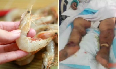 Woman Suffers Organ Failure and Dies After Accidentally Cutting Finger When Cleaning Shrimps - WORLD OF BUZZ 4