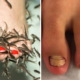 Young Woman Shockingly Loses Her Toenails After Going for Fish Pedicure - WORLD OF BUZZ 4