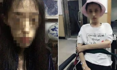 21yo Girl Weighs 25kg After Drastic Dieting, Risks Death From Brain Injury - WORLD OF BUZZ 3