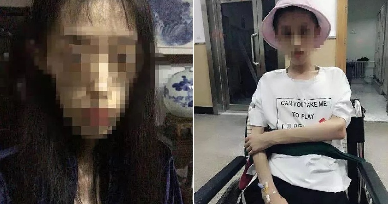 21yo Girl Weighs 25kg After Drastic Dieting, Risks Death From Brain Injury - WORLD OF BUZZ 3