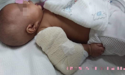 3-Month-Old M'sian Baby Boy Suffers Broken Arm Allegedly from Nanny's Ill-Treatment - WORLD OF BUZZ 3