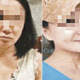 60yo Woman Undergoes Plastic Surgeries to Look Like 20yo to Avoid RM17 Million Debt - WORLD OF BUZZ