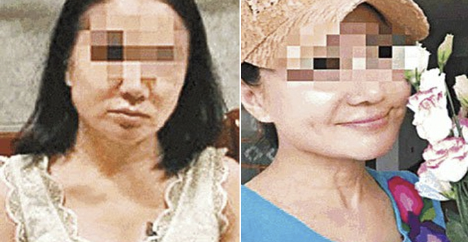 60yo Woman Undergoes Plastic Surgeries to Look Like 20yo to Avoid RM17 Million Debt - WORLD OF BUZZ
