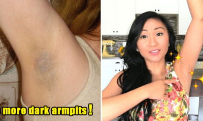 7 Reasons Some Malaysians Have Darker Armpits and How to Avoid Them - WORLD OF BUZZ 7